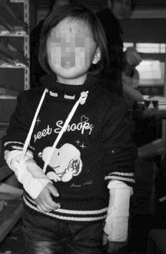 一個小女孩，雙手裹（guǒ）著繃帶，臉上（shàng）還有很多血（xuè）痕